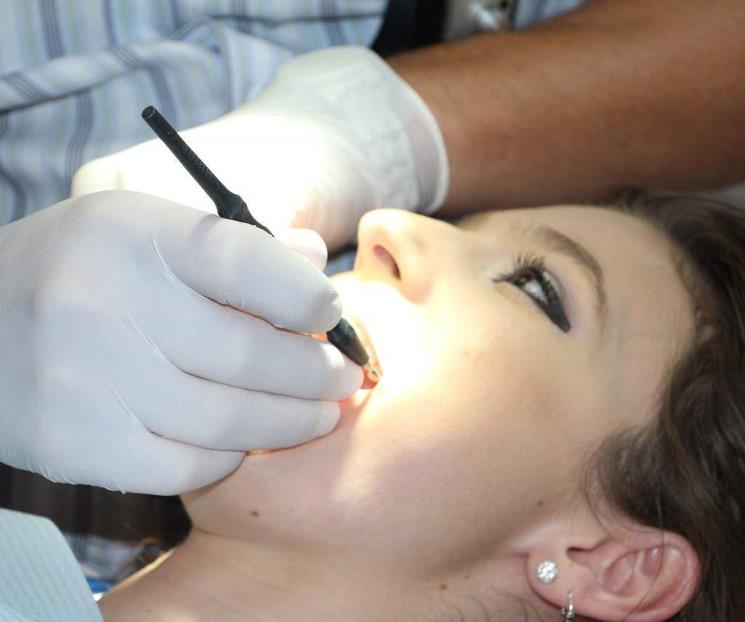 Así puedes eliminar el sarro de los dientes, según especialistas