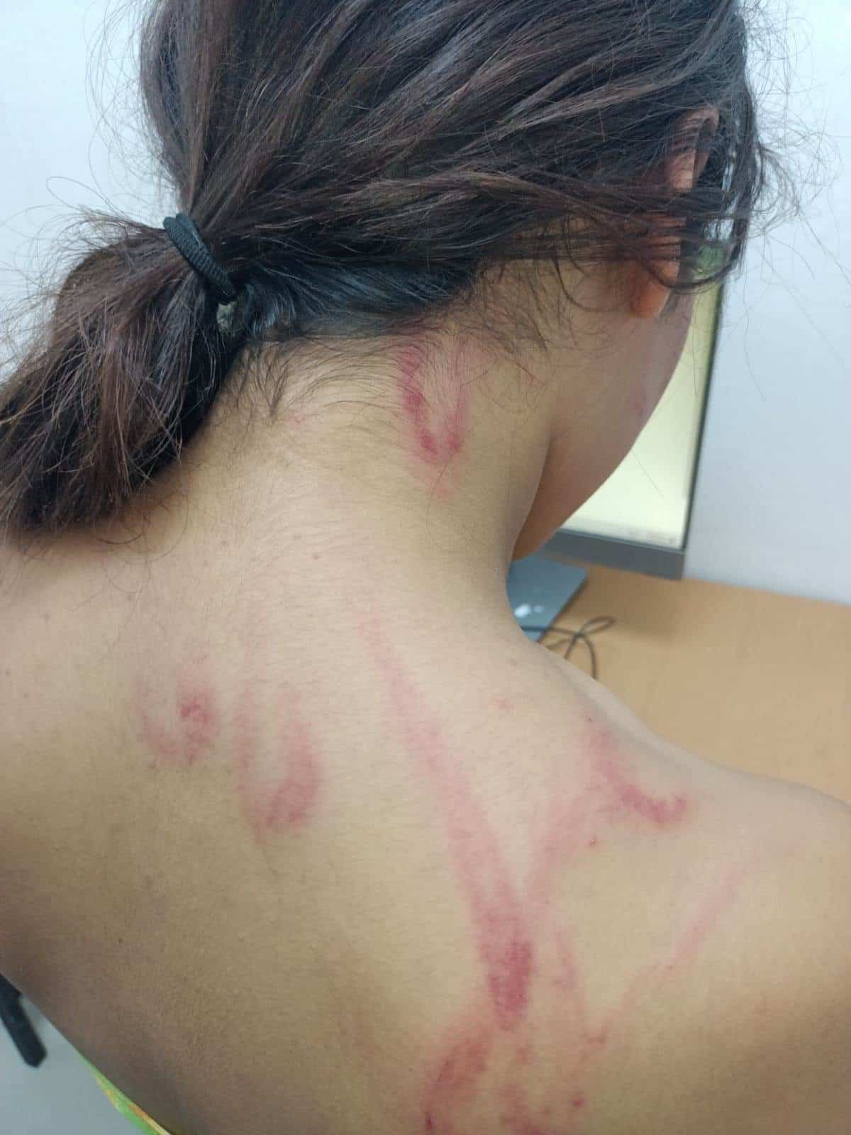 Después de que presuntamente golpeó a su hija con un cable por traer hematomas en el cuello, una mujer fue detenida por policías de Proxpol Escobedo.