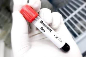 HMPV no representa riesgo para México: Ssa